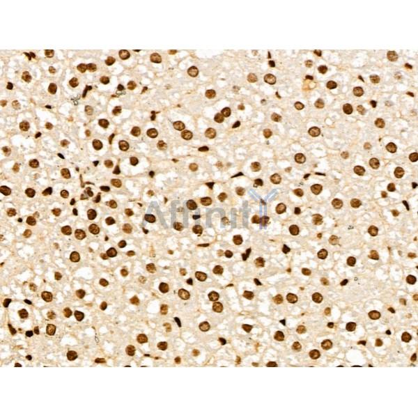 NDOR1 Antibody - DF13177 at 1/100 staining Rat liver tissue by IHC-P.
