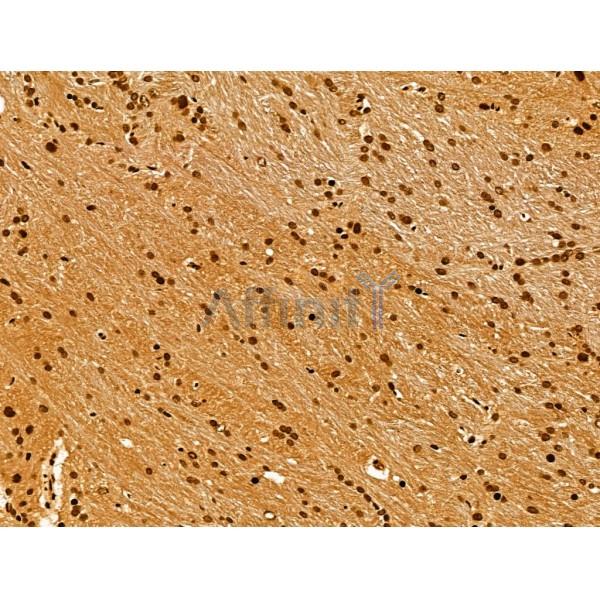 NDOR1 Antibody - DF13177 at 1/100 staining Rat brain tissue by IHC-P.