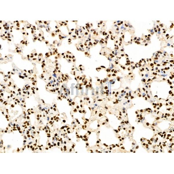 NDOR1 Antibody - DF13177 at 1/100 staining Rat lung tissue by IHC-P.