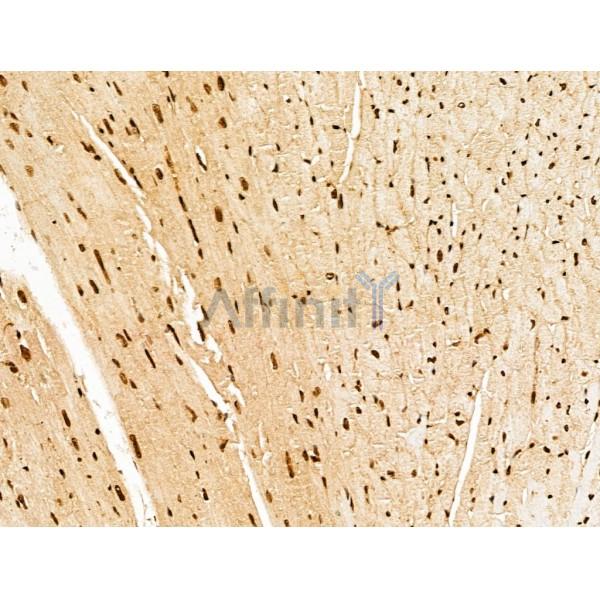 NDOR1 Antibody - DF13177 at 1/100 staining Mouse heart tissue by IHC-P.