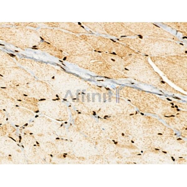 NDOR1 Antibody - DF13177 at 1/100 staining Rat skin tissue by IHC-P.