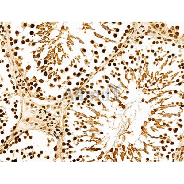 NDOR1 Antibody - DF13177 at 1/100 staining Rat testis tissue by IHC-P.
