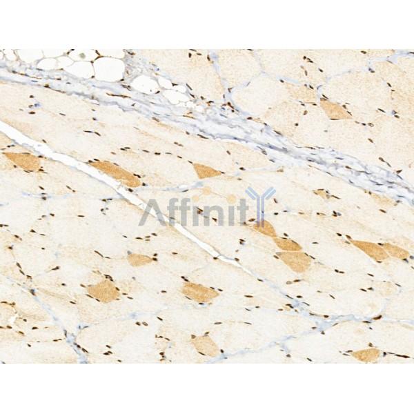 NDUFAF2 Antibody - DF13178 at 1/100 staining Rat skin tissue by IHC-P.