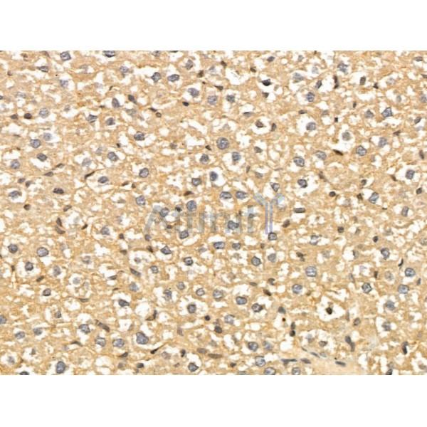 NECAP1 Antibody - DF13180 at 1/100 staining Rat liver tissue by IHC-P.