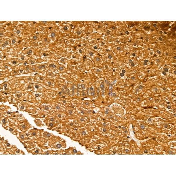 NECAP1 Antibody - DF13180 at 1/100 staining Mouse liver tissue by IHC-P.