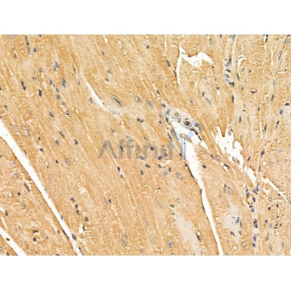 NECAP1 Antibody - DF13180 at 1/100 staining Mouse heart tissue by IHC-P.