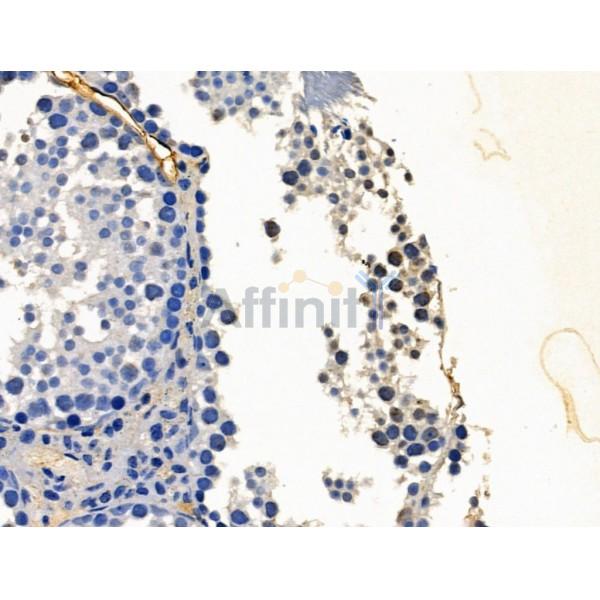 PHF8 Antibody - DF13341 at 1/100 staining Mouse testis tissue by IHC-P.
