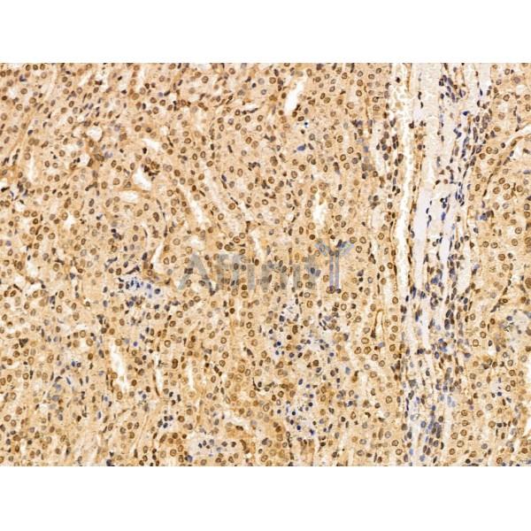 KGF Antibody - DF13342 at 1/100 staining Rat kidney tissue by IHC-P.