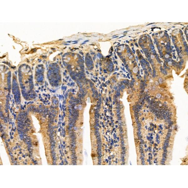 PICALM Antibody - DF13343 at 1/100 staining Mouse colorectal tissue by IHC-P.