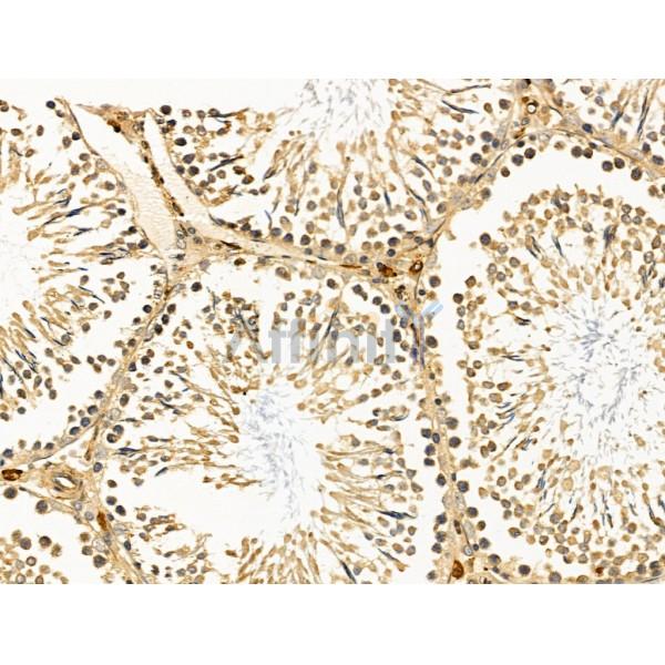 PICALM Antibody - DF13343 at 1/100 staining Rat testis tissue by IHC-P.