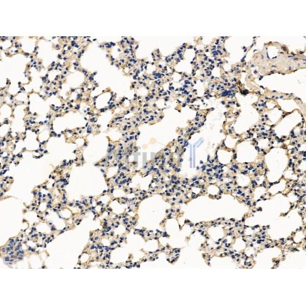 PICALM Antibody - DF13343 at 1/100 staining Mouse lung tissue by IHC-P.