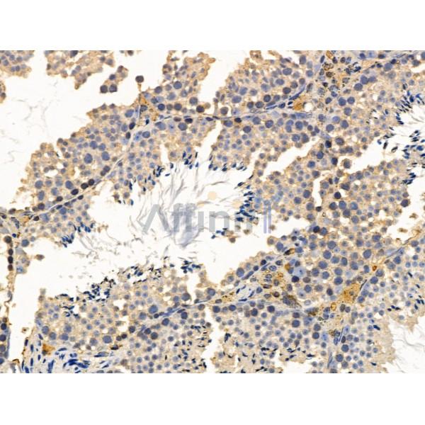 PICALM Antibody - DF13343 at 1/100 staining Mouse testis tissue by IHC-P.