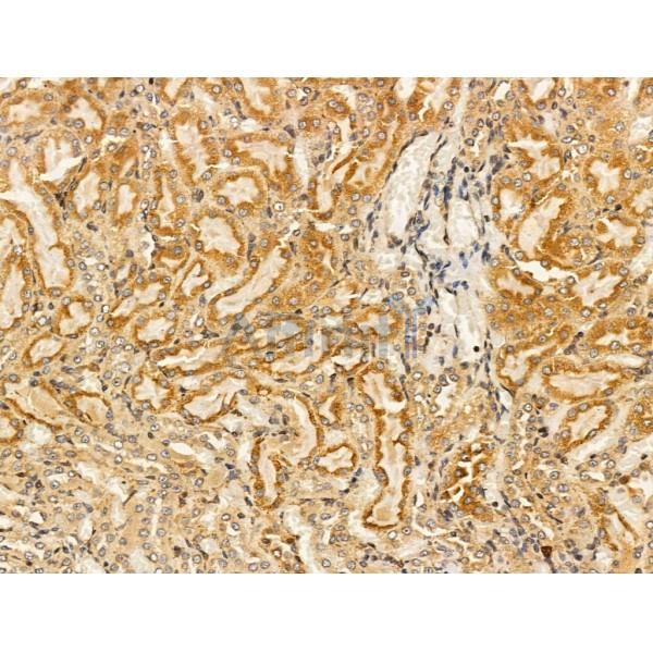 PLVAP Antibody - DF13415 at 1/100 staining Rat kidney tissue by IHC-P.