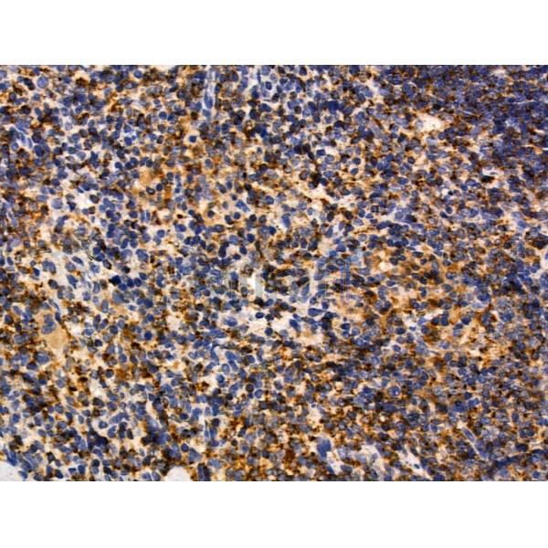MUM1 Antibody - DF13418 at 1/100 staining Mouse spleen tissue by IHC-P.