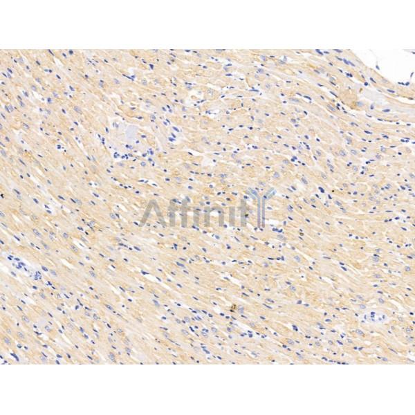 FKBP25 Antibody - DF13423 at 1/100 staining Rat heart tissue by IHC-P.