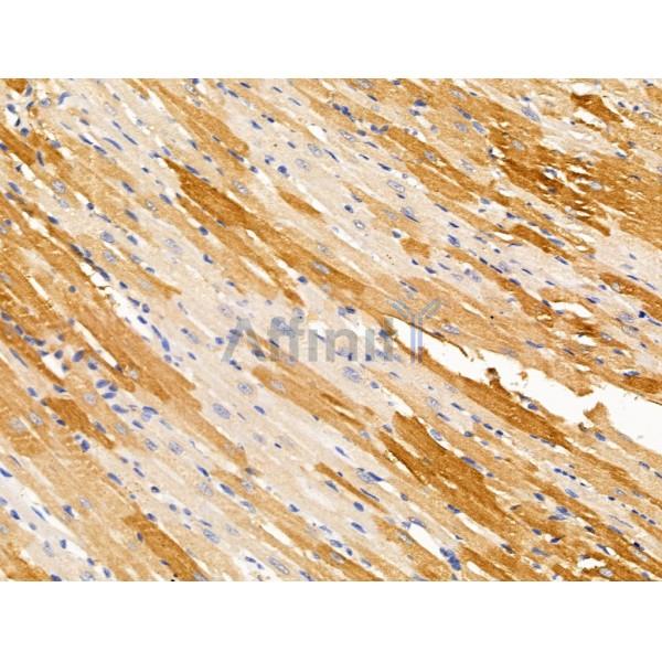 LYRIC Antibody - DF13437 at 1/100 staining Rat heart tissue by IHC-P.