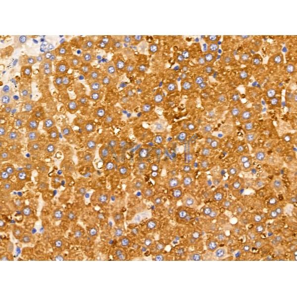 LYRIC Antibody - DF13437 at 1/100 staining Rat liver tissue by IHC-P.