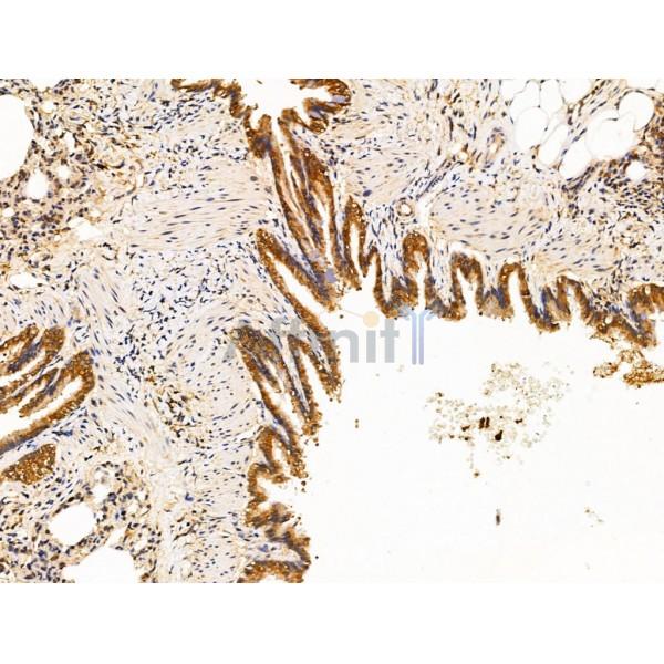 LYRIC Antibody - DF13437 at 1/100 staining Rat lung tissue by IHC-P.