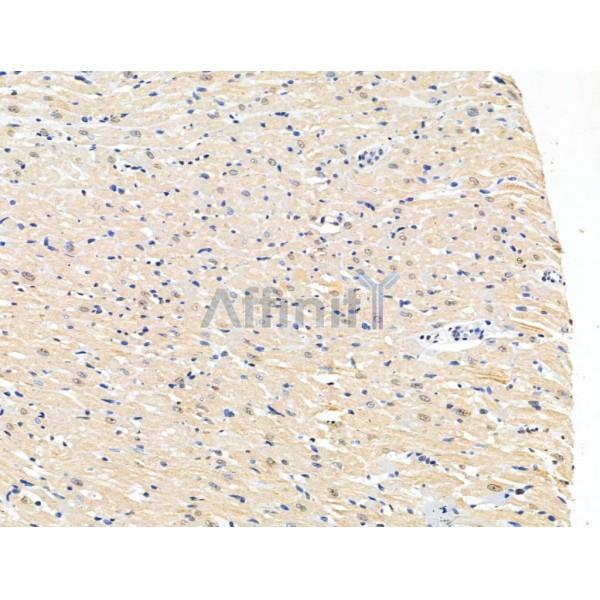 CASC5 Antibody - DF13491 at 1/100 staining Rat heart tissue by IHC-P.