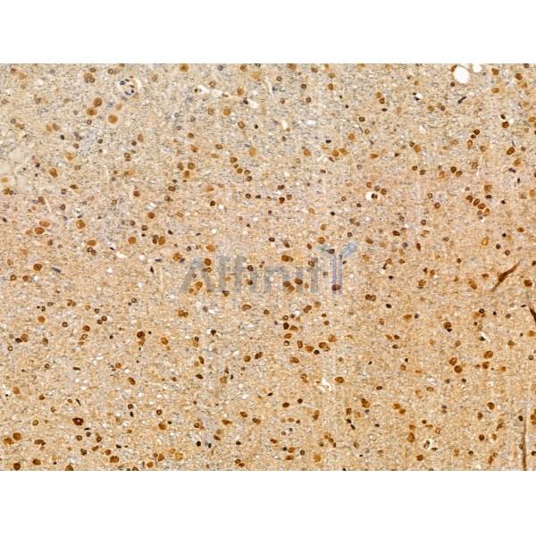 CASC5 Antibody - DF13491 at 1/100 staining Mouse brain tissue by IHC-P.
