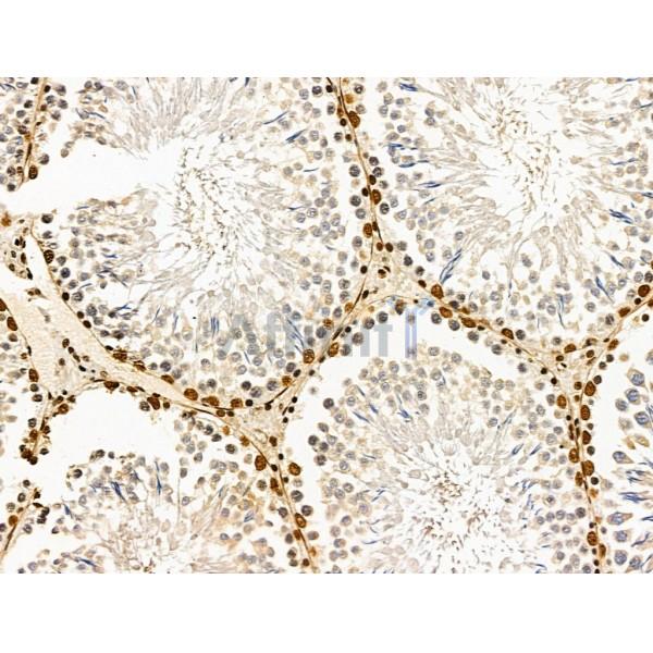 CASC5 Antibody - DF13491 at 1/100 staining Rat testis tissue by IHC-P.