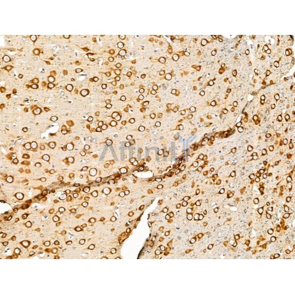 PURA Antibody - DF13493 at 1/100 staining Rat brain tissue by IHC-P.