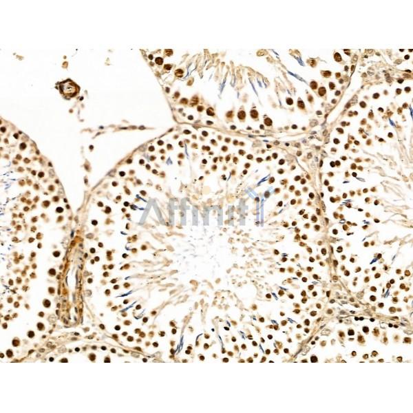 SLFN11 Antibody - DF13515 at 1/100 staining Rat testis tissue by IHC-P.