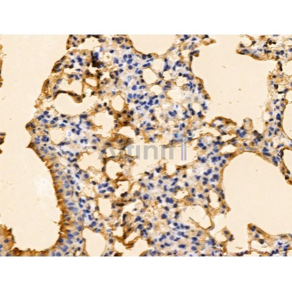 PFD6 Antibody - DF13522 at 1/100 staining Mouse lung tissue by IHC-P.