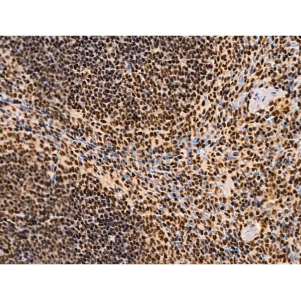 Proprotein Convertase 2 Antibody - DF13531 at 1/100 staining Mouse spleen tissue by IHC-P.