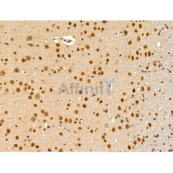 Proprotein Convertase 2 Antibody - DF13531 at 1/100 staining Rat brain tissue by IHC-P.
