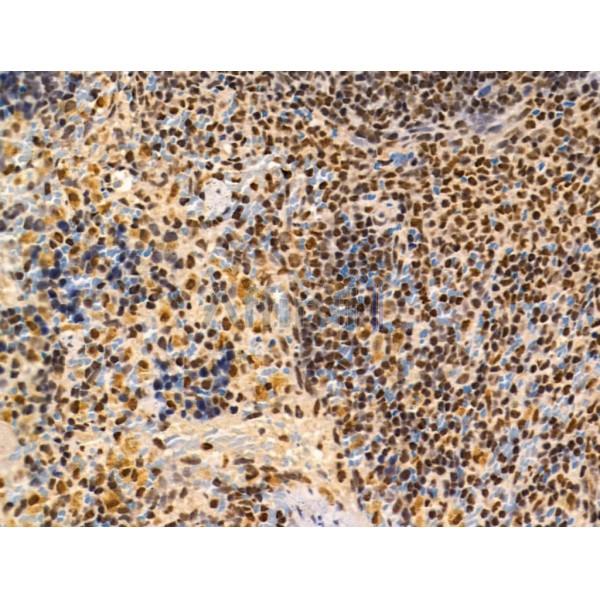 Proprotein Convertase 2 Antibody - DF13531 at 1/100 staining Rat spleen tissue by IHC-P.