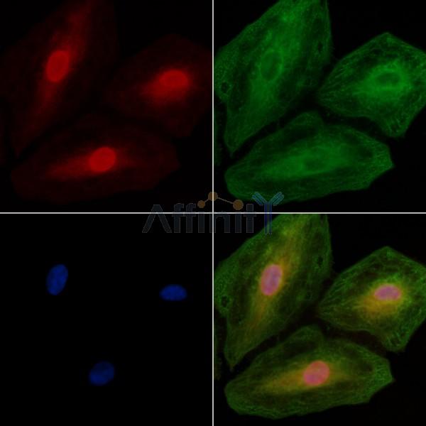 PHAP1 Antibody - DF13532 staining A549 cells by IF/ICC.