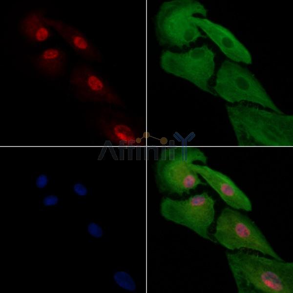 HAND2 Antibody - DF13534 staining A549 cells by IF/ICC.