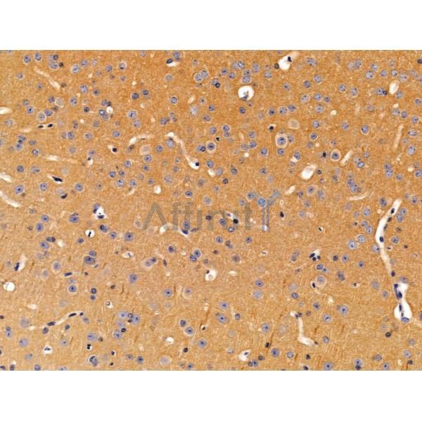 ACTR1A Antibody - DF13535 at 1/100 staining Mouse brain tissue by IHC-P.