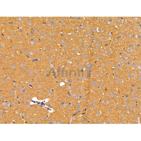 ACTR1A Antibody - DF13535 at 1/100 staining Rat brain tissue by IHC-P.