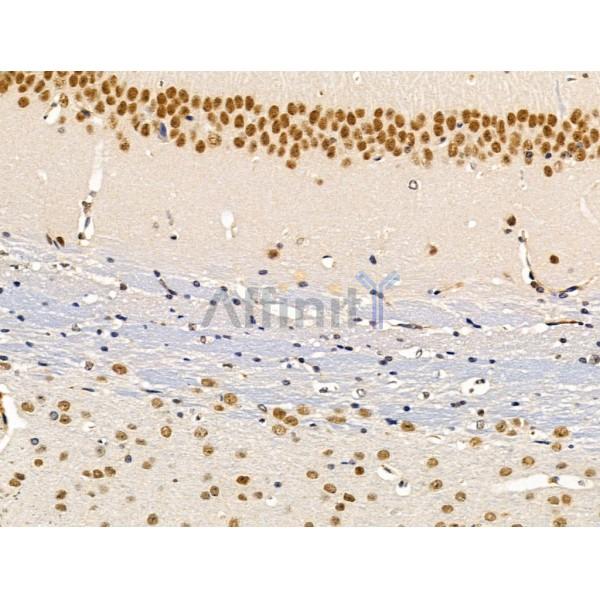 SMARCA1 Antibody - DF13543 at 1/100 staining Mouse brain tissue by IHC-P.