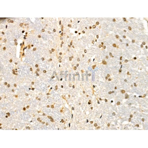 SMARCA1 Antibody - DF13543 at 1/100 staining Rat brain tissue by IHC-P.