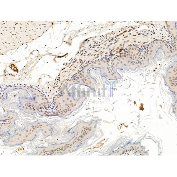 SMARCA1 Antibody - DF13543 at 1/100 staining Mouse stomach tissue by IHC-P.