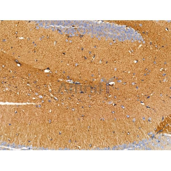 DPP6 - Catalytic domain Antibody - DF13546 at 1/100 staining Mouse brain tissue by IHC-P.
