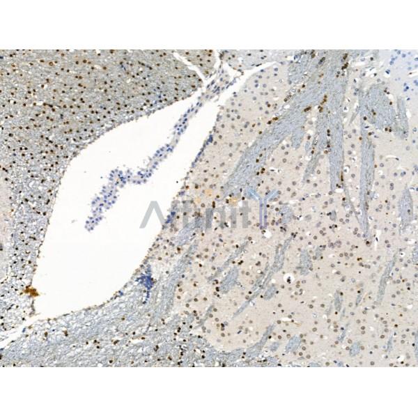 KMT2A / MLL Antibody - DF13551 at 1/100 staining Mouse brain tissue by IHC-P.