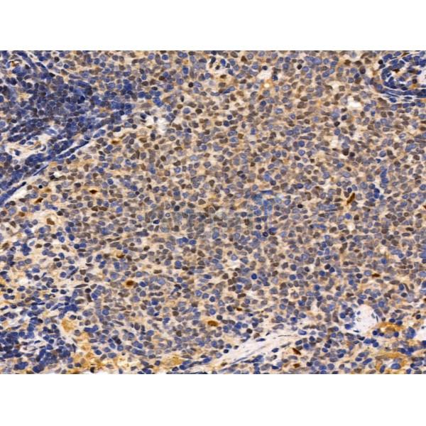KMT2A / MLL Antibody - DF13551 at 1/100 staining Rat spleen tissue by IHC-P.