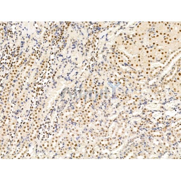 KMT2A / MLL Antibody - DF13551 at 1/100 staining Rat brain tissue by IHC-P.