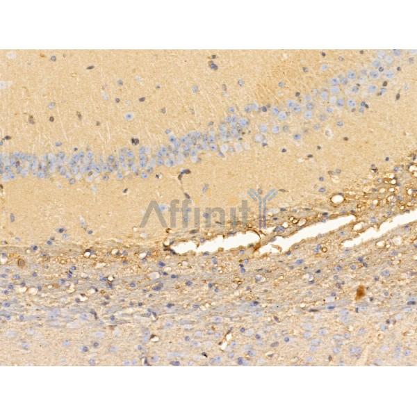 Kinesin 5 C Antibody - DF13556 at 1/100 staining Mouse brain tissue by IHC-P.