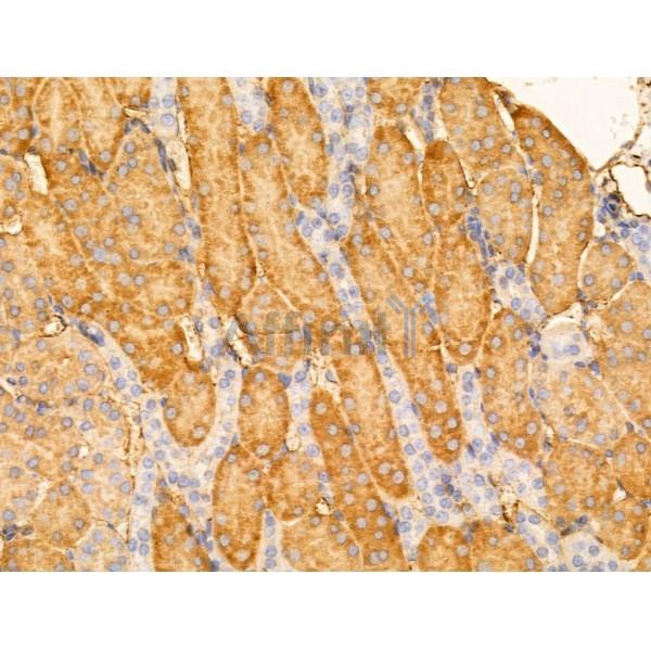 Kinesin 5 C Antibody - DF13556 at 1/100 staining Mouse kidney tissue by IHC-P.