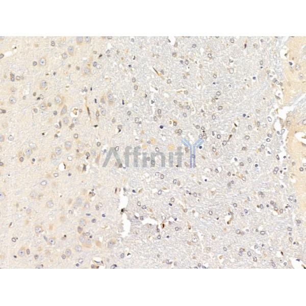 C9orf142 Antibody - DF13585 at 1/100 staining Rat brain tissue by IHC-P.