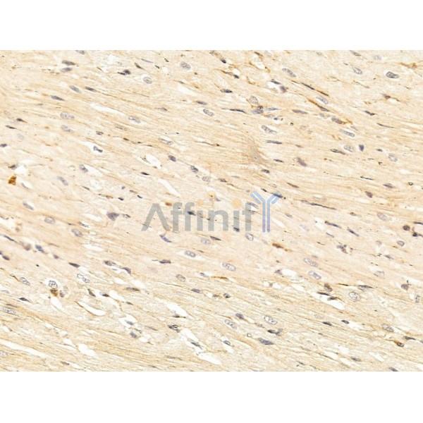 C9orf142 Antibody - DF13585 at 1/100 staining Rat heart tissue by IHC-P.