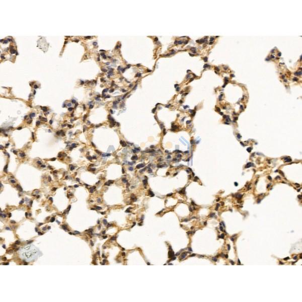 THRAP5 Antibody - DF13586 at 1/100 staining Mouse lung tissue by IHC-P.