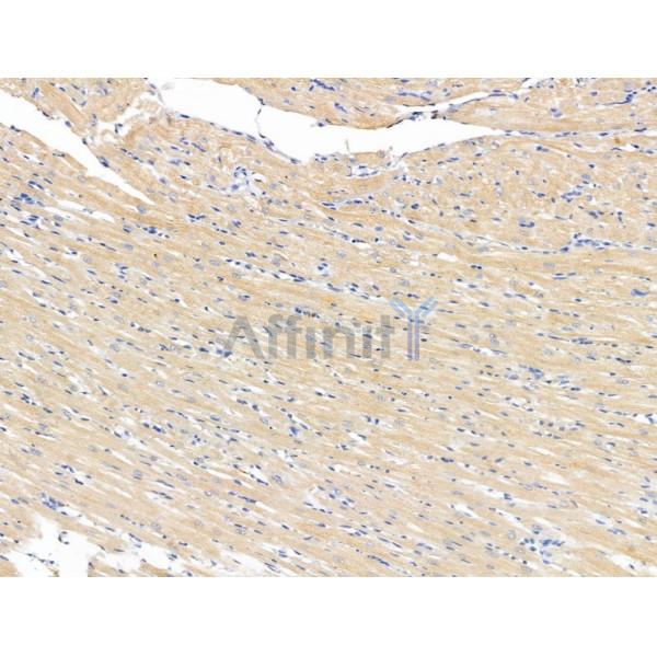 beta II Tubulin Antibody - DF13588 at 1/100 staining Rat heart tissue by IHC-P.