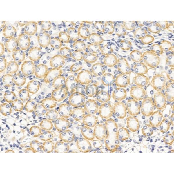 PTCH2 Antibody - DF13589 at 1/100 staining Mouse kidney tissue by IHC-P.