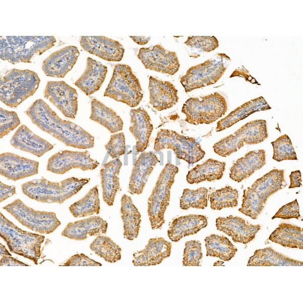 Sulfatase 1 Antibody - DF13592 at 1/100 staining Mouse colorectal tissue by IHC-P.